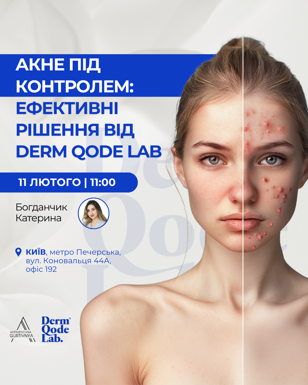 11.02.2025 - Акне під контролем: ефективні рішення від Dermqodelab