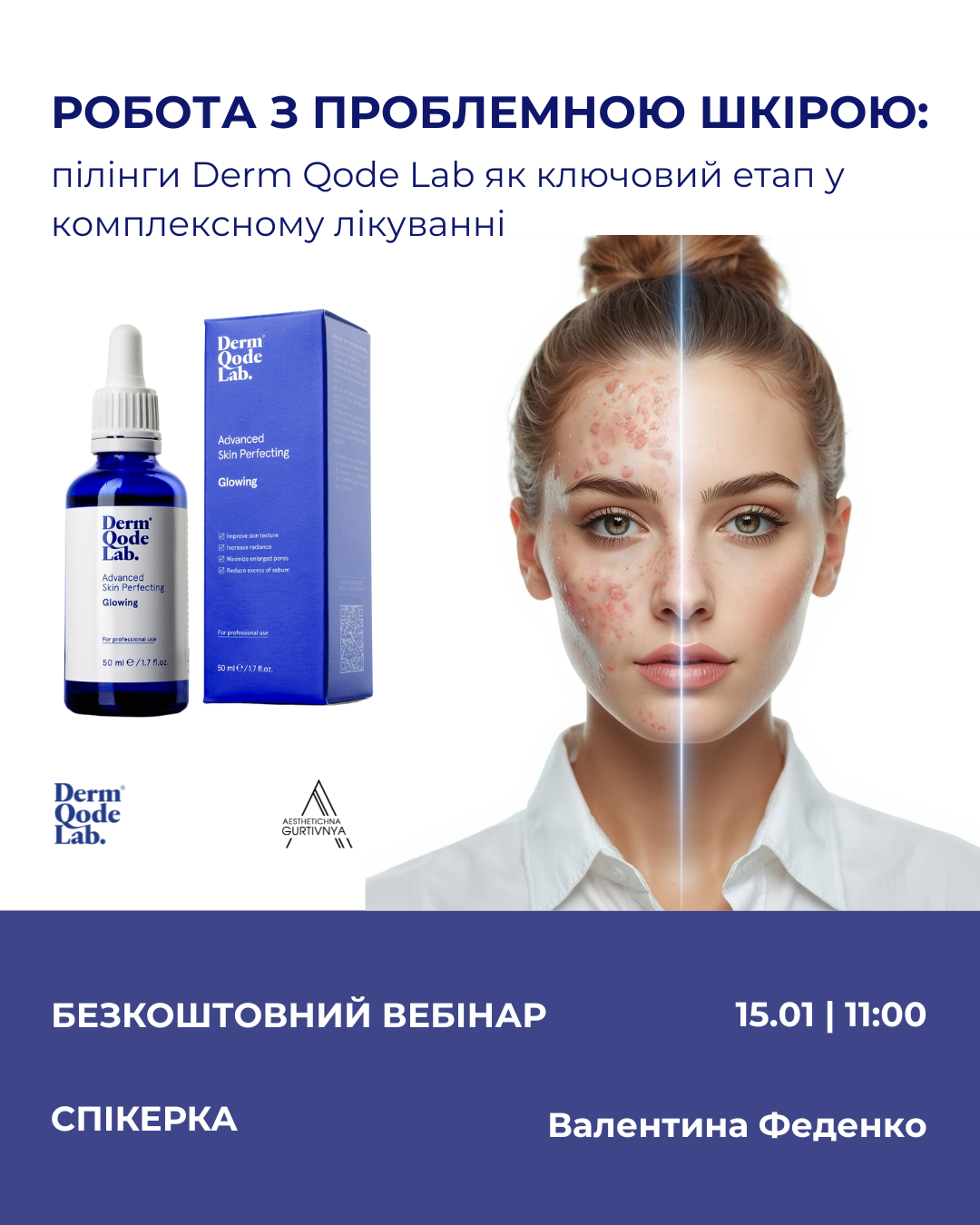 15.01.2026 - Робота з проблемною шкірою: пілінги Derm Qode Lab як ключовий етап у комплексному лікуванні